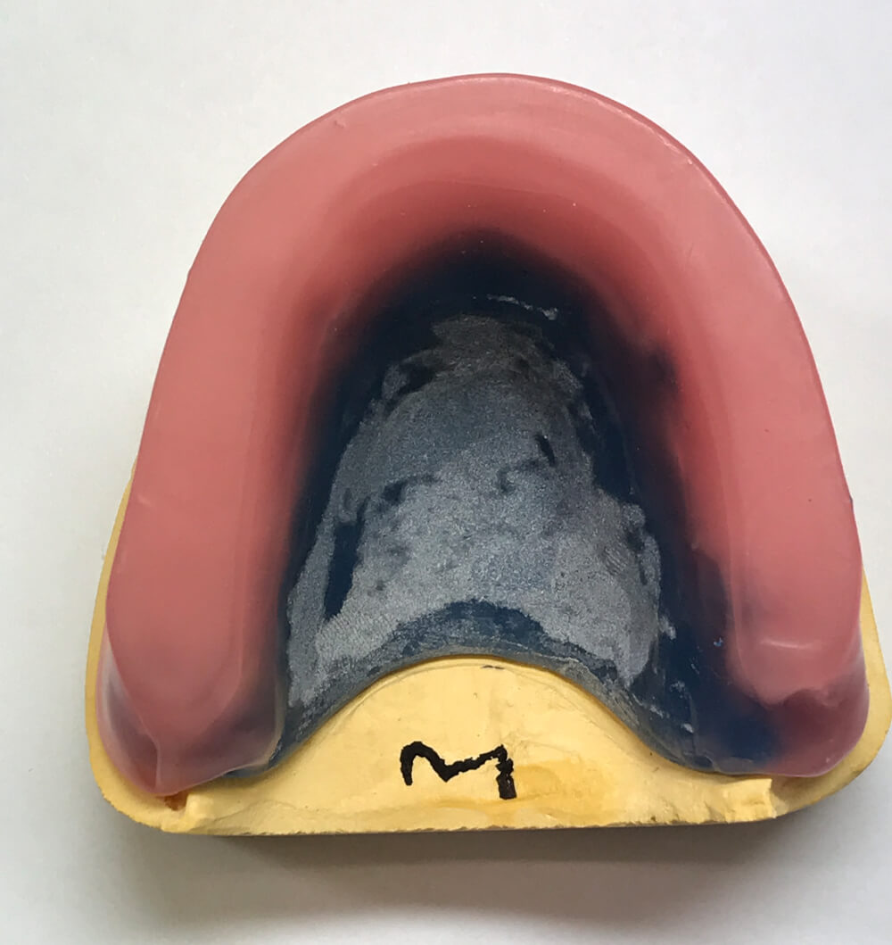 wax rim for upper mouth part of the denture process